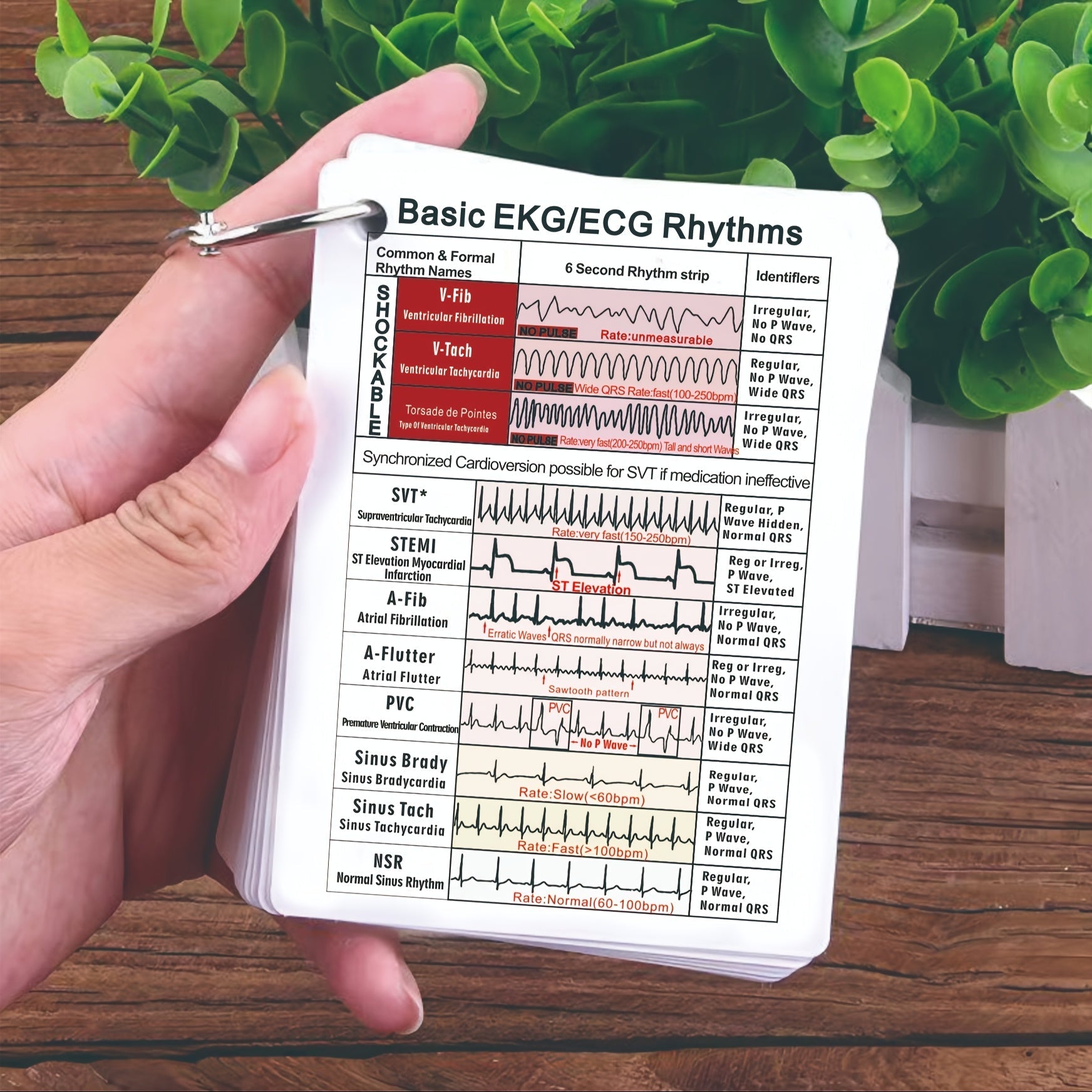 Nursing Reference Cards, Nursing Cards, Nursing Badge Cards, Nursing Clinical Cards, Nursing Badge Auxiliary Cards, Medical Student Flash Cards, ECG Rhythm and Ecliptial Syndrome Related Content, Suitable for Medical Health C - Mothscrubs